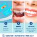 Dr. Nick's White & Healthy Professional Teeth Whitening Strips - 20 Treatments, Dentist Formulated for Sensitive Teeth - Buy Online on GoSupps.com