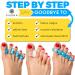 Sixora Premium Gel Toe Separators for Overlapping Toes - Toe Straighteners, Spacers, Hammer Toe & Bunion Corrector - Correct Your Toes Naturally! - Buy Online on GoSupps.com