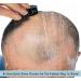 Omnishaver Head Razor for Men Fastest Bald Head & Body Shaver | Durable Hair Clipper with Self-Cleaning Feature - Buy Online on GoSupps.com