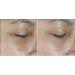 RoC Multi Correxion Revive + Glow Eye Balm Vitamin C + Peptide Formula Dark Circle Reduction Touchless Application Eye Cream - 4g - Buy Online on GoSupps.com