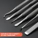 BEZOX Ingrown Toenail Removal Kit - Stainless Steel Tools for Pedicure - 6 PCS Set - Buy Online on GoSupps.com