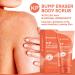 KP Bump Eraser Body Scrub - Exfoliating Strawberry Legs Treatment for Women & Men - 8.45oz - Buy Online on GoSupps.com