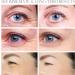 Retinol Stick Face Cream & Under Eye Balm - Anti Aging & Brightening Formula for Fine Lines and Dark Circles - 3g - Buy Online on GoSupps.com