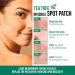 Kiss New York Hydrocolloid Acne Pimple Patch for Zits and Blemishes Korean Skin Care Spot Treatment Stickers for Face and Body Made in Korea (Large) - Buy Online on GoSupps.com