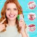 32PCS Slim Interdental Brushes & Orthodontic Flossers for Braces | Deep Cleaning Tool for 0.7-0.8mm Gaps | Best Oral Hygiene Solution - Buy Online on GoSupps.com