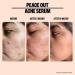 Peace Out Skincare Acne Serum - 2% Salicylic Acid Face Serum for Pimples, Zits, Blemishes | Clearer Skin | 1 fl oz - Buy Online on GoSupps.com