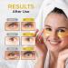 Under Eye Patches for Puffy Eyes & Dark Circles - 30 Pairs | Reduce Eye Bags - Shop Internationally - Buy Online on GoSupps.com