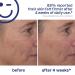 Kate Somerville Breakout Dream Team: EradiKate 3% Sulfur Daily Foaming Cleanser Acne Treatment 4 oz. and Mega-A Skin Transforming Anti-Aging Serum with Retinal 1 oz. - Buy Online on GoSupps.com