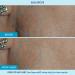 RescueMD DNA Repair Complex Scar Treatment Serum 15mL - Post-Procedure & Skin Damage Solution - Buy Online on GoSupps.com