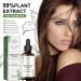 Shelure Hair Growth Oil Shelure Hair Regrowth Oil Shelure Hair Regrowth Treatment Oil Natural Hair Growth Oil Hair Regrowth Extract Oil Hair Growth Oil for Women (1) - Buy Online on GoSupps.com