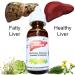 ALKAVITA Liver Support Cleanse - Pure Organic Fatty Liver Purifier & Detox Concentrate Drops with Artichoke, Dandelion, Chamomile, and Horsetail - Buy Online on GoSupps.com