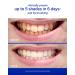 Supersmile Whitening Toothpaste - Wild Mint Flavor - Pack of 2 (8oz Tubes) - Best International Shipping - Buy Online on GoSupps.com