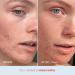 First Aid Beauty - Ultra Repair Cream Colloidal Oatmeal Strengthens Skin Barrier in 7 Days & Helps Relieve Eczema & Dermatitis Relief - Grapefruit Scent 12 oz - Buy Online on GoSupps.com