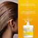 Antifungal Psoriasis Deep Conditioner Treatment for Eczema & Seborrheic Dermatitis | Soothes Itching Repairs Scalp Strengthens Hair & Stimulates Regrowth | Shop Internationally - Buy Online on GoSupps.com