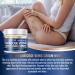 Hermon Varicose and Spider Veins Cream Natural Formula to Improve Circulation Soothe Tired Legs & Reduce Swelling Vein Treatment for Long Standing 3.4 Fl Oz (Pack of 1) - Buy Online on GoSupps.com