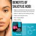 BRIGHTJUNGLE Pimple Patches for Face - Acne Hydrocolloid Treatment with Salicylic Acid (144 Count) - Buy Online on GoSupps.com