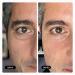 Geologie Dark & Puffy Under Eye Cream | Fight Dark Circles & Puffiness | 10 ML Daily Eye Cream with Kojic Acid, Caffeine & Hyaluronic Acid | 90 Day Supply | 1 Count - Buy Online on GoSupps.com