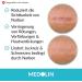 Medolin Scar Ointment - Reduce Scar Visibility | Certified EU Scar Angel | Easy Application 19g - Buy Online on GoSupps.com