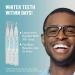 USA Made Sensitive Teeth Whitening Pens - 35% Carbamide Peroxide Gel - Stain Remover & Whitener - Professional Teeth Whitening (3 Pcs) - Buy Online on GoSupps.com