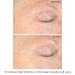 StriVectin Peptight Serum - Lift & Tighten Face & Eyes, Reduce Fine Lines - Buy Online on GoSupps.com