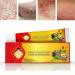 Face Cream Body Cream Anti-Itch Cream Chinese Herbal Cream Skin Repairing Cream for Face Body Healthy Skin Treatment Antifungal Cream Treatment Ointment Cream for Itchy Skin Moisturizing Skin Cream