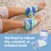 Zentoes Moisturizing Heel Socks - 2 Pairs of Gel-Lined Toe-Free Spa Socks for Dry Cracked Heels - Blue Batik Color - Buy Online on GoSupps.com