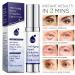 Rapid Anti-Aging Eye Cream - Visibly Reduces Wrinkles, Bags & Dark Circles in 120 Seconds - Hydrating & Lifting Formula (10mL) - Buy Online on GoSupps.com