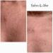 Buy Kami Pure Silicone Gel Anti-Wrinkle Chest Patch - Hydrate & Plump Skin Botox Alternative Single Pack for Anti-Aging Solution - Buy Online on GoSupps.com