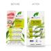 Dr. Organic Tea Tree Lip Balm | Moisturizing SPF 15 | Vegan Paraben & SLS-Free | 5.7ml - Ideal for Men & Women - Buy Online on GoSupps.com