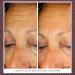 Droplette Retinol Renewer Capsules - Reduce Crease Lines & Revitalize Skin with Arbutin Rose Oil & Collagen (30 Count) - Shop Internationally - Buy Online on GoSupps.com