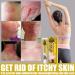 Eczema and Psoriasis Relief Cream Set - Soothes Irritated Skin, Treats Tinea Versicolor - 2pcs - Buy Online on GoSupps.com