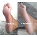 Buy Mosadal Foot Bath - Effortless Callus Removal & Foot Care | International Shipping Available - Buy Online on GoSupps.com