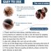ShengKou Natural Flea & Tick Collar for Large Dogs - 2 Pack with Essential Oils - Buy Online on GoSupps.com