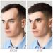 Hair Growth Shampoo for Men & Women | Advanced Rice Water Formula Biotin-Enriched for Thicker Stronger Hair - Natural Solution for Thinning & Hair Loss - Buy Online on GoSupps.com