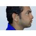 NewEAR Hearing Amplifier Ear ITC (Pair) - Extra Small - Second Generation - Buy Online on GoSupps.com