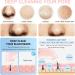 Blackhead Remover Pore Vacuum Cleaner - USB Rechargeable Electric Suctioner with 3 Probes, Upgraded Facial Pore Cleaner in Light Pink - Buy Online on GoSupps.com