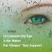 Viteyes Tear Support - Occasional Dry Eye Supplement Eye Vitamin for Redness Relief & Allergy Support | Omega-3 Fish Oil 30 Softgels - Buy Online on GoSupps.com