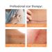 Strataderm Professional Scar Therapy Gel | For Old & New Scars from Surgery, Burns, Acne & Skin Conditions | Reduces Redness, Discomfort & Itch | 5g - Buy Online on GoSupps.com
