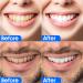 Advanced 5D Teeth Whitening Strips - Gentle on Sensitive Teeth - 14 Sessions for a Brighter, Whiter Smile - Buy Online on GoSupps.com