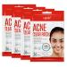 Epielle Acne Clear Patch- Translucent Hydrocolloid Acne Pimple Patch for Zits and Blemishes Face and Skin Spot Treatment Acne Stickers| 4 Pack Acne Pimple Patch Spot Treatment | Cruelty-Free | Two Patch Sizes 8mm & 10 m...