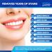 Teeth Whitening Kit & Whitening Strips + LED Light Activator | 50 Whitening Sessions | 8X3ml Gels | Crystal Strips | UK Approved Formula | Safe On Teeth & Gums | Home Stain Remover Dental Kit - Buy Online on GoSupps.com