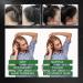 Richolyn Rosemary Oil for Hair - Hydrating Essence for Dry Scalp & Damaged Hair (2.02 fl. oz) - Nourishment for Bleached & Dry Hair - Buy Online on GoSupps.com