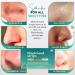 LivaClean Pore Strips (75 CT) with Salicylic Acid & Witch Hazel - Effective Blackhead Remover for Face & Nose - Ideal for Pore Cleansing & Blackhead Removal - Buy Online on GoSupps.com
