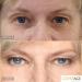 Jerome Alexander CoverAge Eye Concealer - 5-in-1 Anti-Aging Concealer Stick with Eye Roller Ball - Buy Online on GoSupps.com