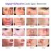 Dark Spot Remover Serum for Face & Body | Age Sun Spots, Freckles, Melasma Treatment | 4-Butylresorcinol, Kojic Acid, Hyaluronic Acid - 50ml - Buy Online on GoSupps.com