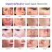 Dark Spot Remover for Face and Body - Melasma & Freckle Corrector - Hyperpigmentation Treatment - Buy Online on GoSupps.com
