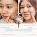 Buy 72 Pimple Patches with Triple Oil Infusion - Salicylic Acid Tea Tree & Centella Oil for Acne Relief - Fast International Shipping - Buy Online on GoSupps.com