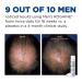Mens Rogaine 5% Minoxidil Foam - Hair Loss Treatment - 1-Month Supply - Buy Online on GoSupps.com