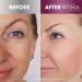 Retinol Anti-Aging Facial Oil | Glow Boosting Radiance & Hydration | Nine Essential Oils for Youthful Skin - Buy Online on GoSupps.com