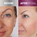 Retinol Anti-Aging Sheet Mask - Hydrating Vitamin-Enriched Treatment for Firming Face and Minimizing Wrinkles - Buy Online on GoSupps.com